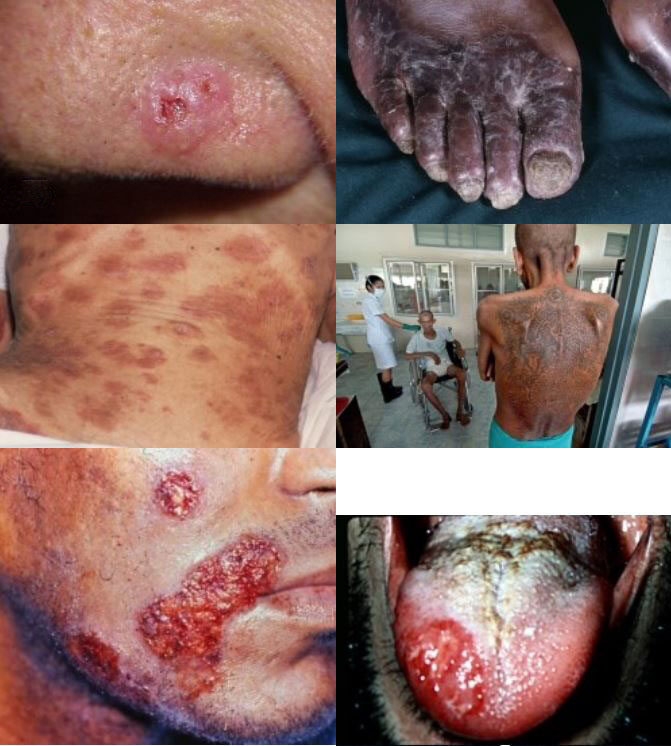 청소년들에게 동성간 항문 성관계에 의해 HIV 바이러스가 전파되어 걸리는 에이즈에 대해 알려야 한다..JPG