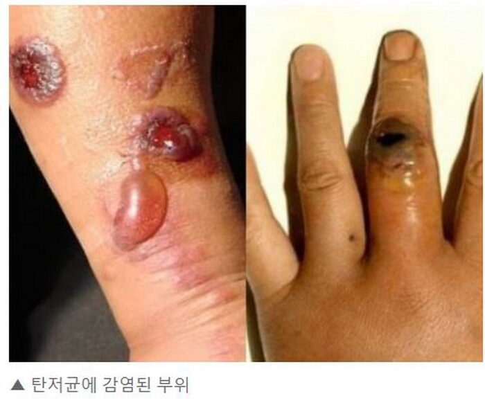 탄저균3.JPG